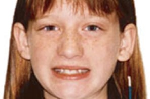 Young girl smiling at camera, demonstrating results of orthodontic treatment with straight teeth.