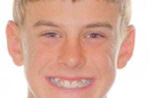 Young person smiling brightly, displaying teeth after orthodontic treatment with braces.