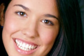 After Samon Smiles treatment in Plano, TX– smooth, well-aligned teeth with a natural smile.