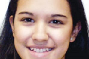 Before treatment – child with crooked and slightly misaligned teeth.