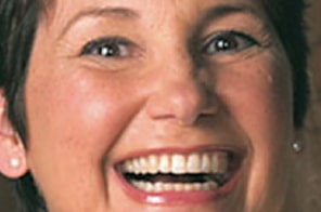 After Damon Smiles treatment  in Plano, TX– broad smile with even, straight teeth.
