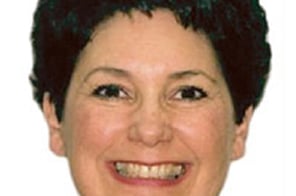 Before treatment – teeth with mild crowding and uneven bite.