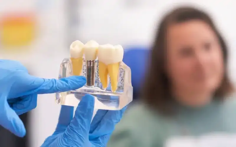 Dentist holding dental implant model showing tooth replacement options for patients.