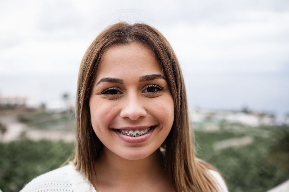 What to Expect When Getting Your Braces Removed